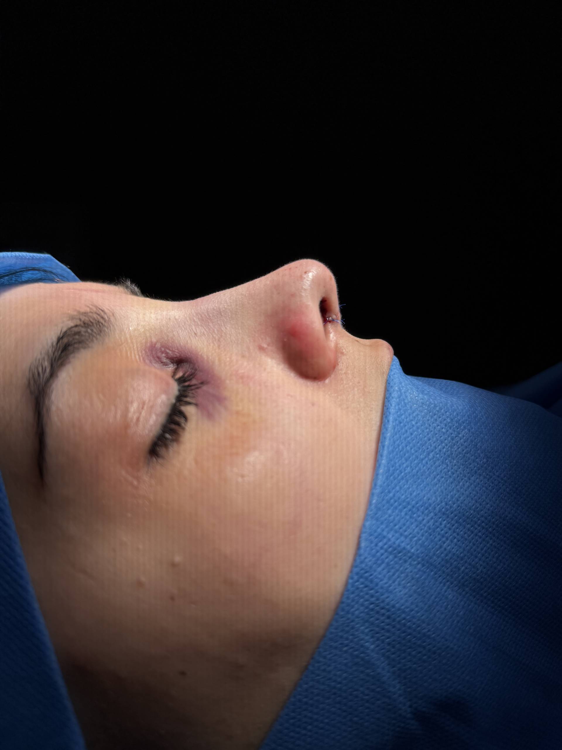 After
