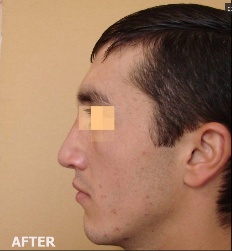 After