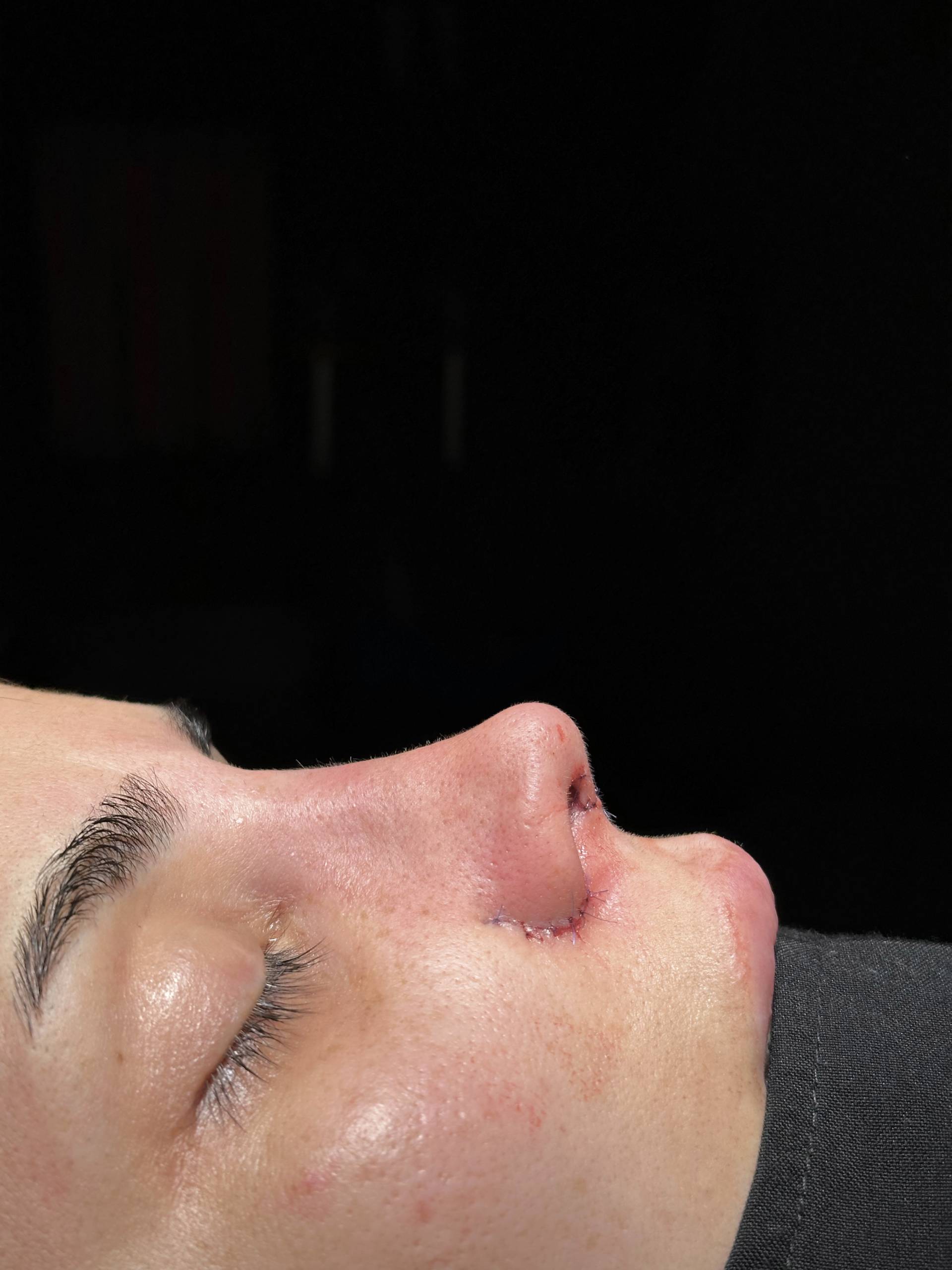 After
